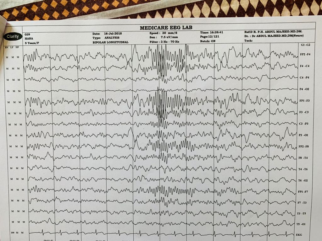 Patient Story